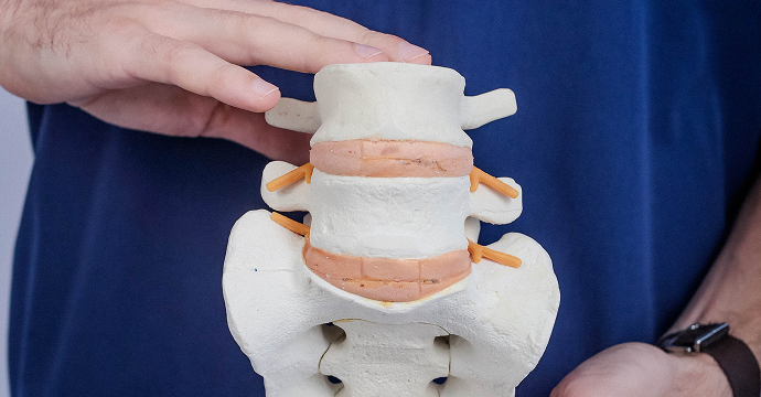 Изображение услуги Резорбция грыжи диска