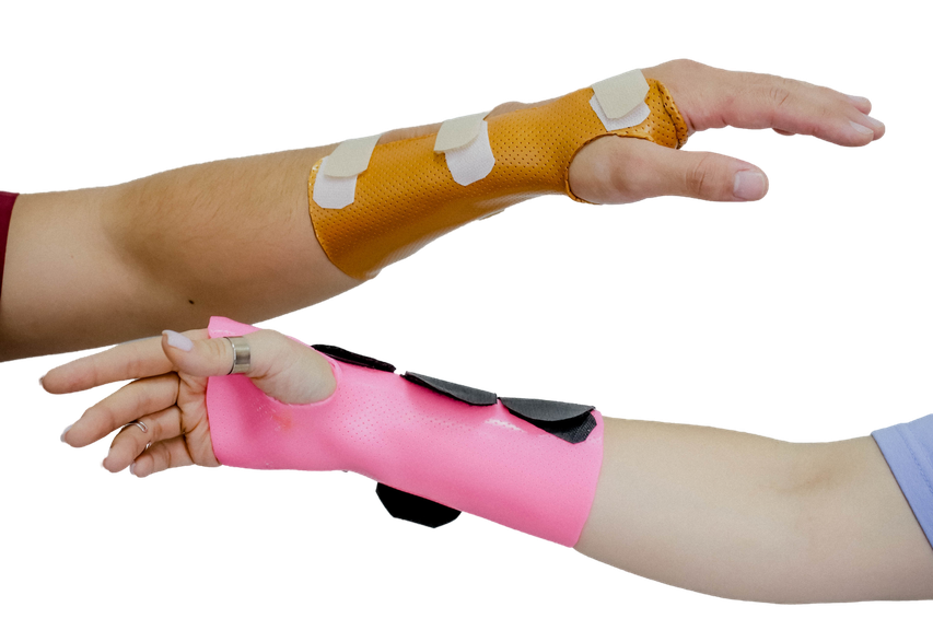 Изображение услуги Кистевая терапия