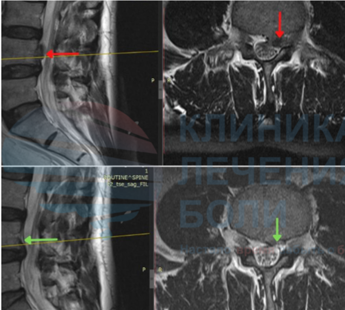 Изображение результата Пациент, М, 60 лет