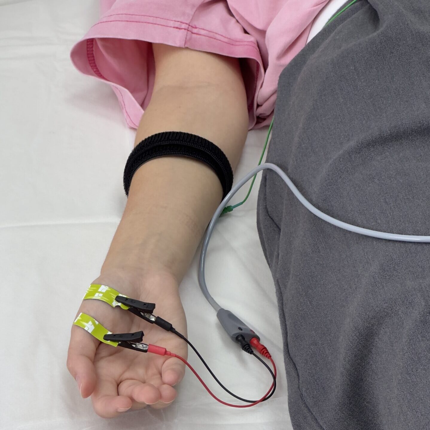 Исследование нервов (ЭНМГ)